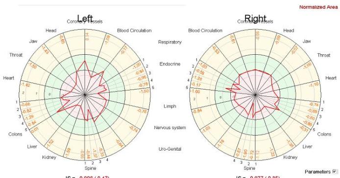 João Jorge diagrama 11-08-05 PM wild