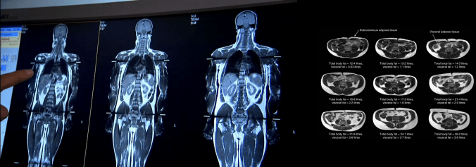 Validade do Índice de Massa&nbsp;Corporal